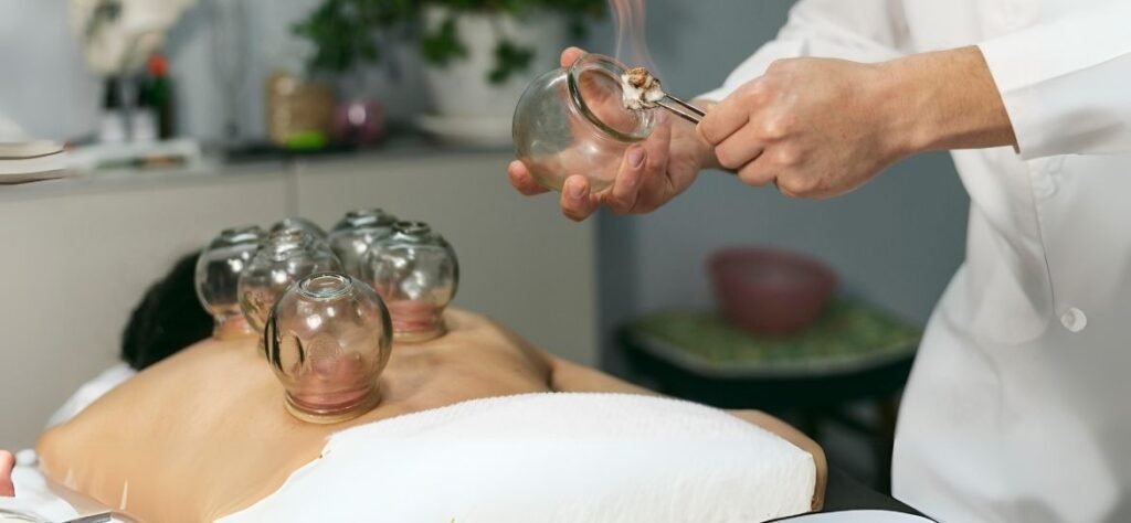 Can I workout after cupping