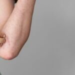 Why does pre-workout make you itchy?